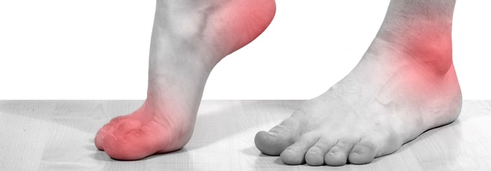 Plantar Fasciitis Pain is Not Just in the Foot
